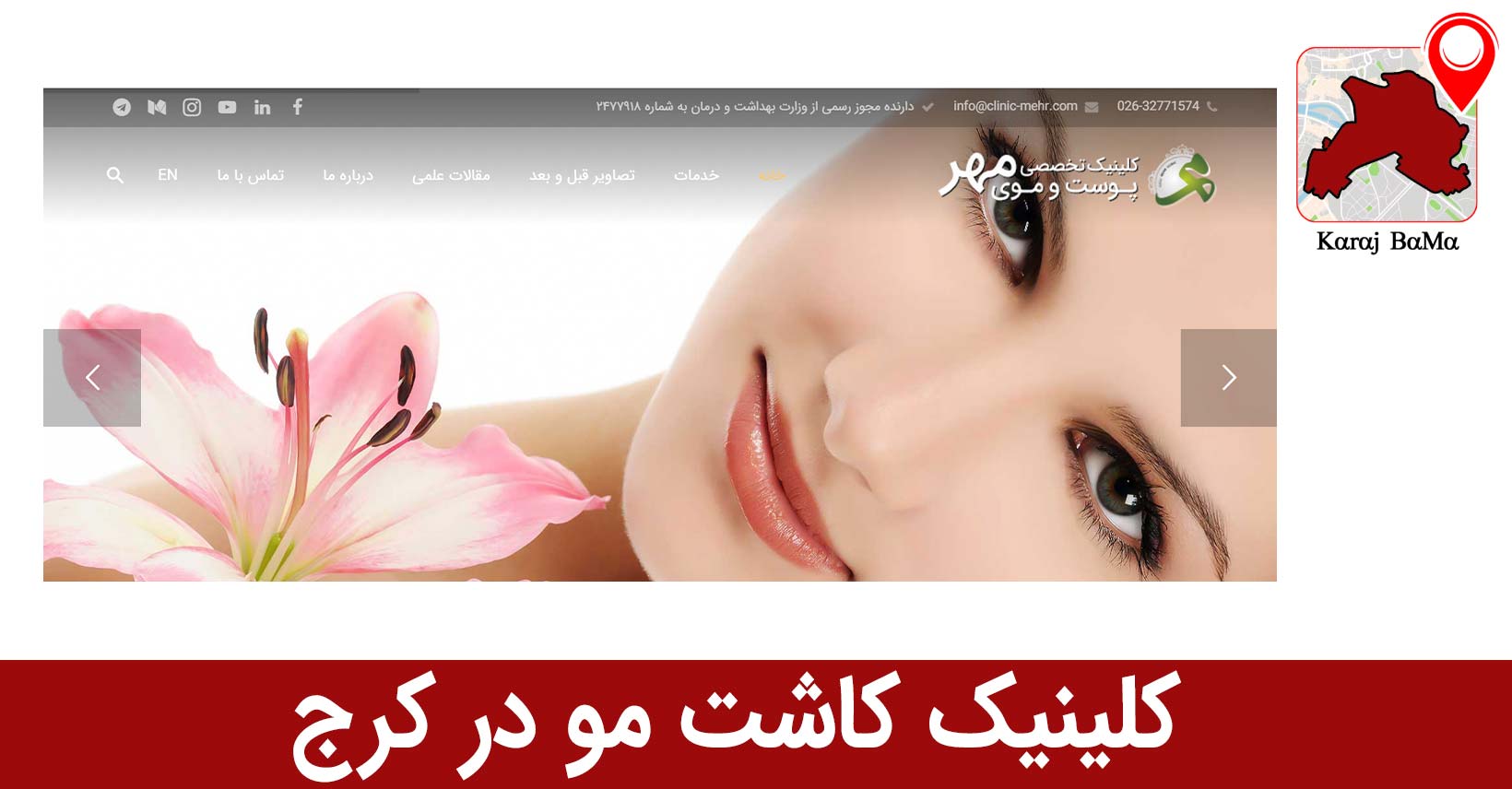 کلینیک کاشت مو در کرج
