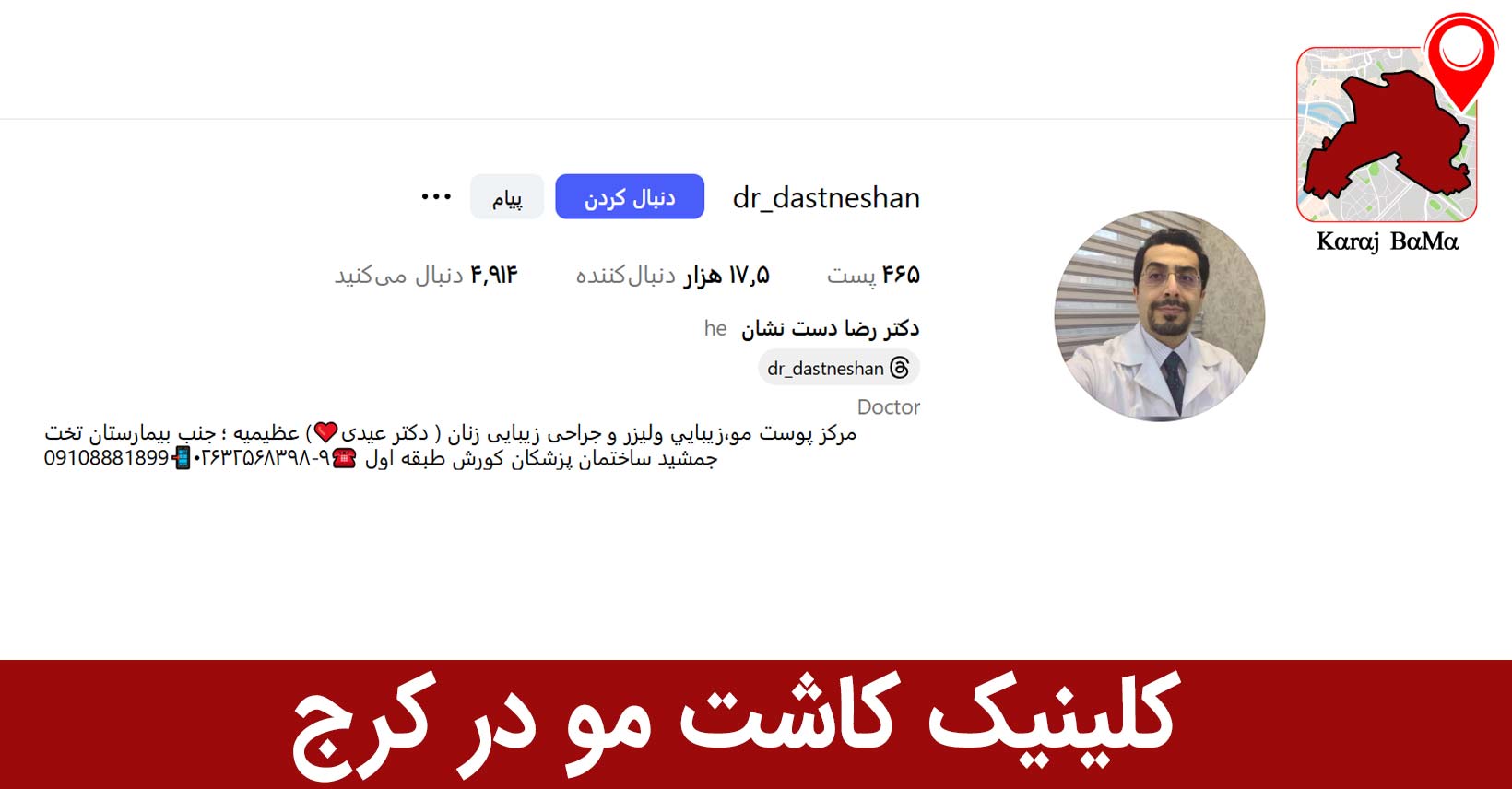 کلینیک کاشت مو در کرج