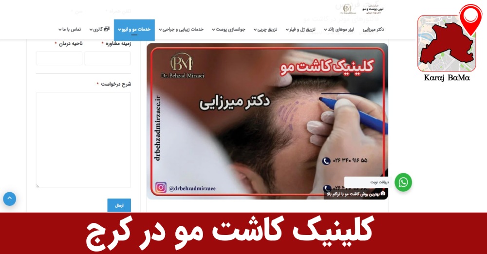 کلینیک کاشت مو دکتر بهزاد میرزایی در کرج