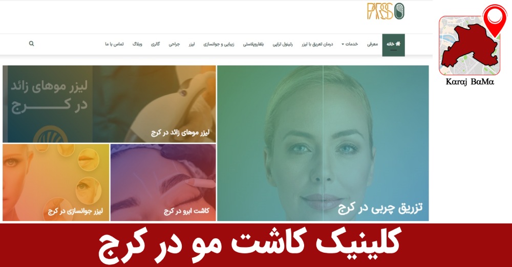 کلینیک کاشت مو پارسیس در کرج
