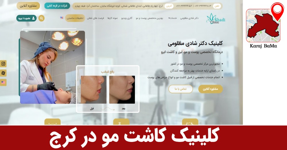 کلینیک کاشت مو دکتر شادی مظلومی در کرج