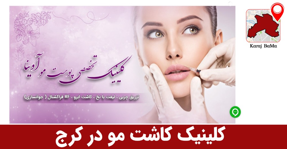 کلینیک کاشت مو آوینا در کرج